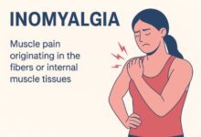 Inomyalgia: Breaking the Stigma Around Chronic Pain Conditions