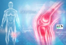 attrities