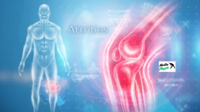 attrities