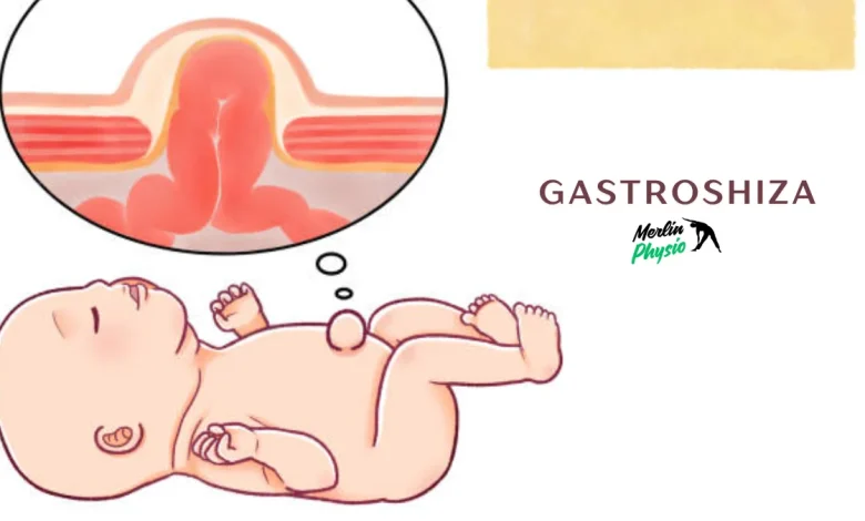 gastroshiza