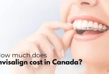 Invisalign cost