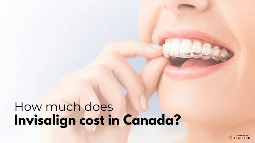 Invisalign cost