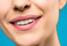 Area around the mouth