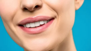 Area around the mouth