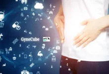 gynecube