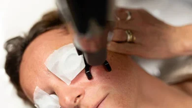 Laser Sun Spot Removal